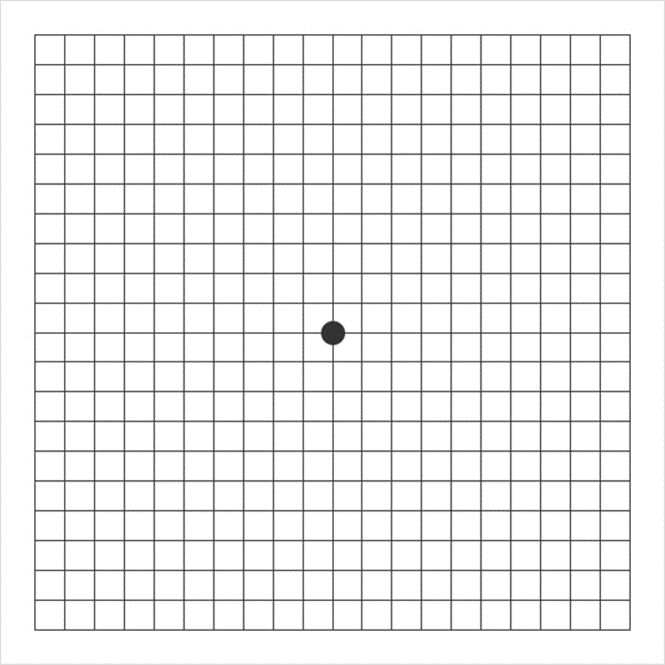 황반변성 자가진단