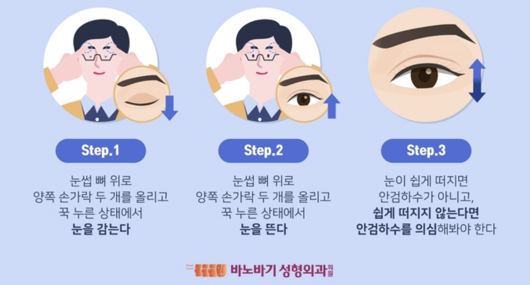 안검하수 자가진단