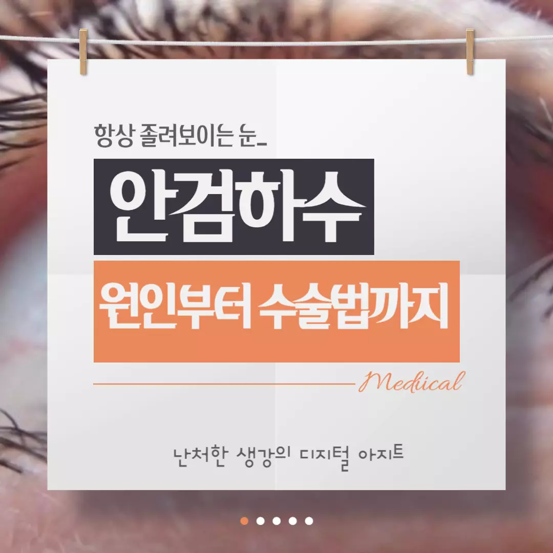 졸려보이는 눈 안검하수 썸네일