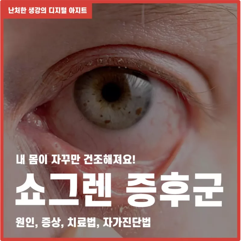 내 몸이 자꾸 건조해져요 쇼그렌 증후군 썸네일