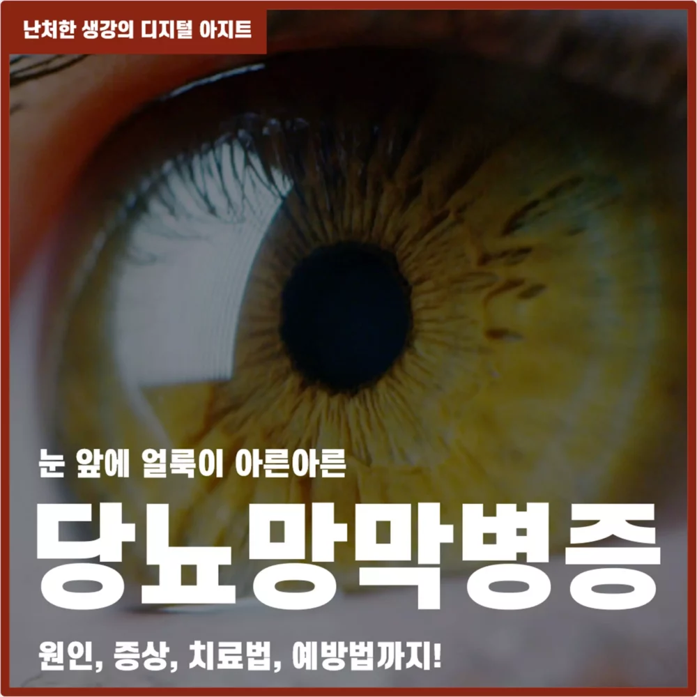 눈 앞에 얼룩이 아른아른 당뇨망막병증 썸네일