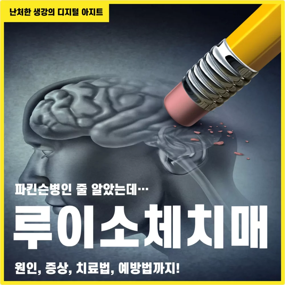 파킨슨병인 줄 알았는데 루이소체치매 썸네일