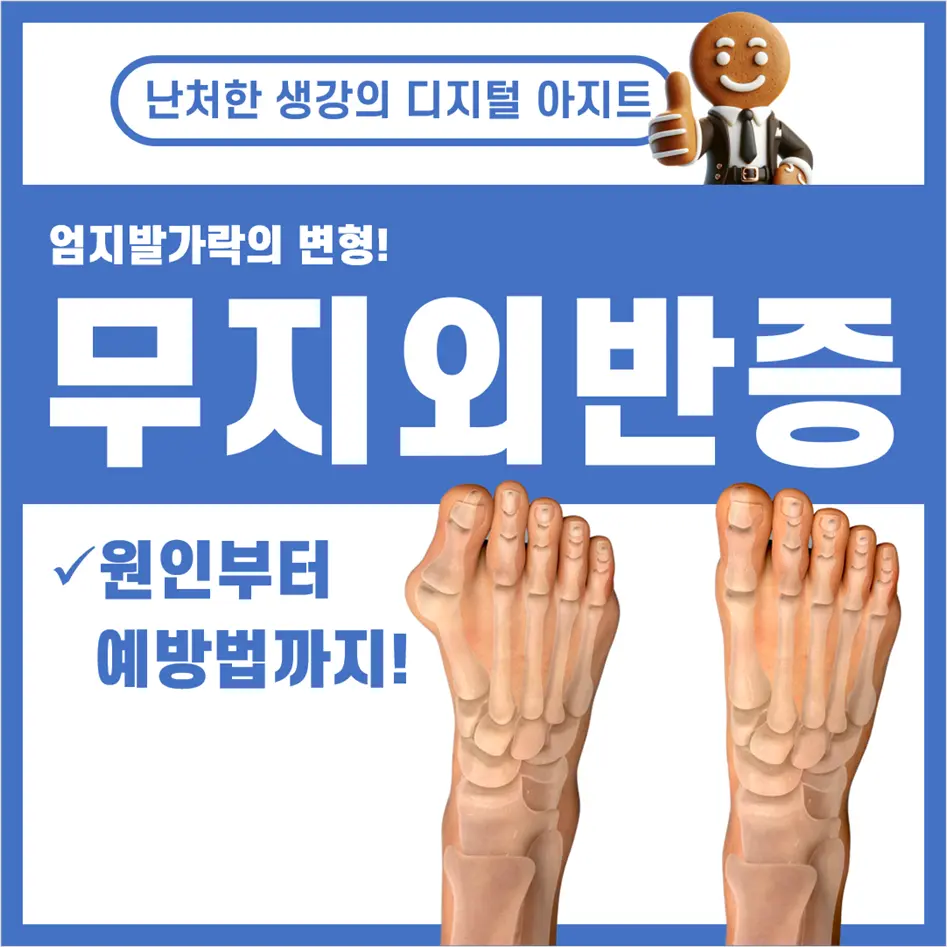 무지외반증 썸네일
